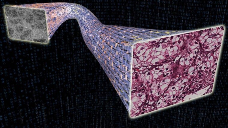 AI watching AI: Dangerous errors in digital pathology caught by UCLA system